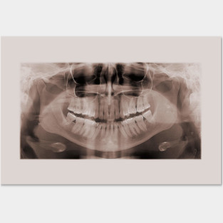 teeth Posters and Art