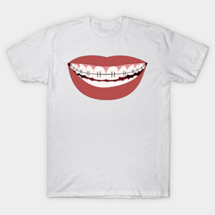 Big smile teeth braces mask design T-Shirt