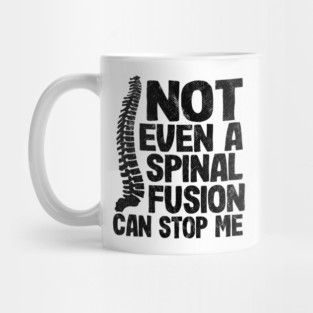 Not Even A Spinal Fusion Can Stop Me Back Surgery Mug