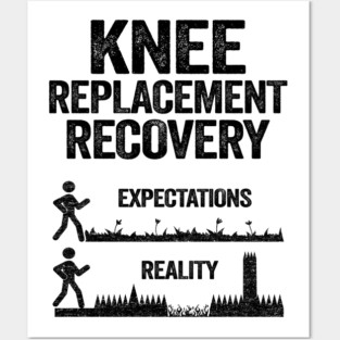 Knee Replacement Recovery Expectations Reality Posters and Art