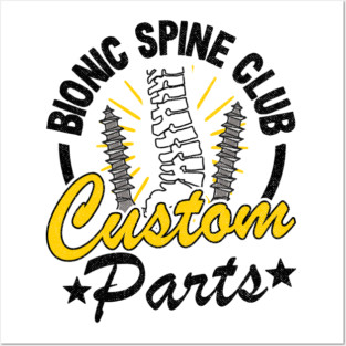 Bionic Spine Club Custom Parts Surgery Spinal Fusion Get Well Posters and Art