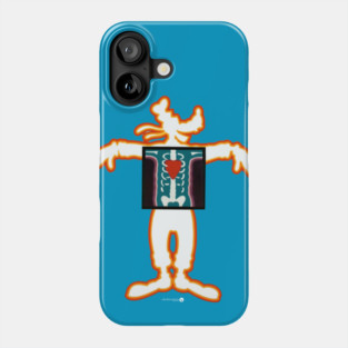 X-Ray Phone Case