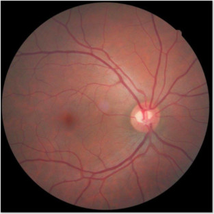 Eyebal X-ray Posters and Art