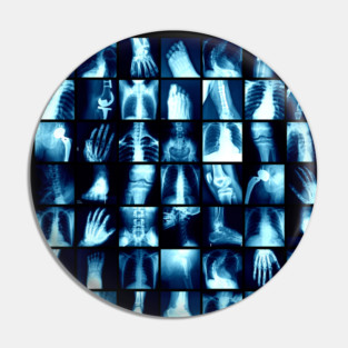 X-Ray Human Skeleton Bones Pin