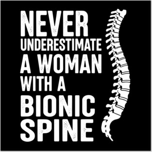 Spinal Fusion Art For Men Women Kids Spine Surgery Posters and Art