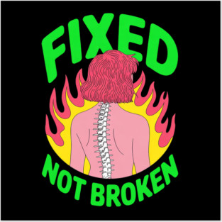 Back Surgery Fixed Not Broken Fun Mens Surgery Recovery Posters and Art