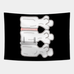 Aftermath of the back 2 Tapestry